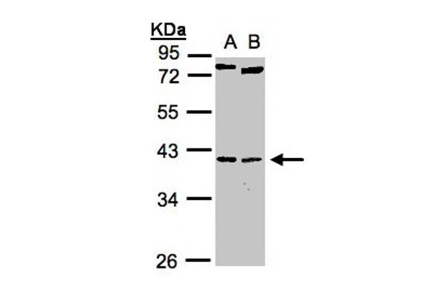 NKX2-5 antibody from Signalway Antibody (22771) - Antibodies.com