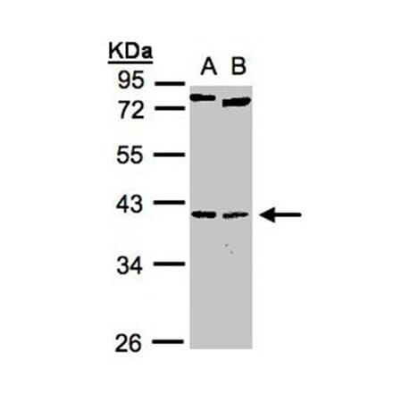 NKX2-5 antibody from Signalway Antibody (22771) - Antibodies.com