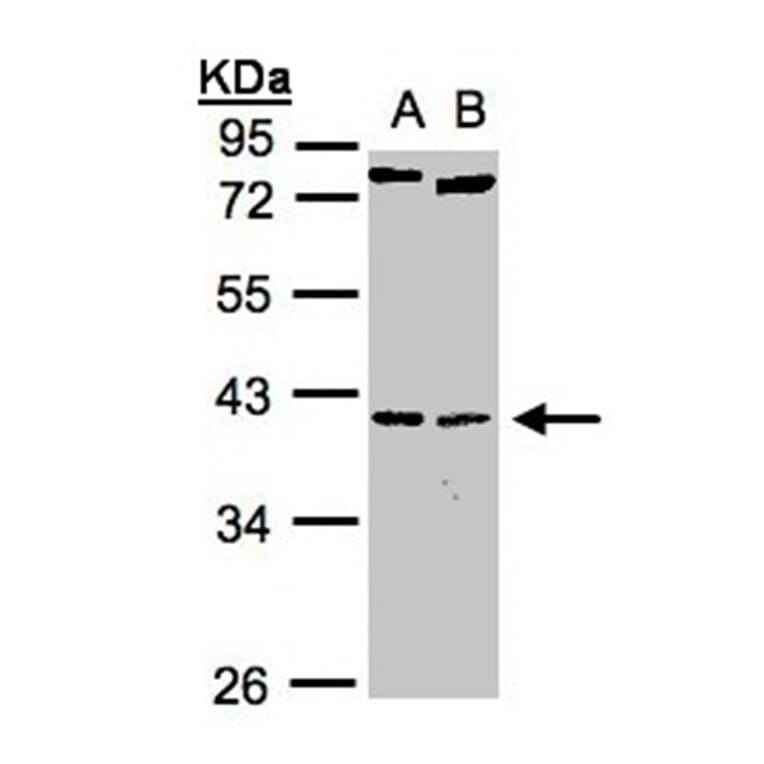 NKX2-5 antibody from Signalway Antibody (22771) - Antibodies.com