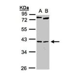 NKX2-5 antibody from Signalway Antibody (22771) - Antibodies.com