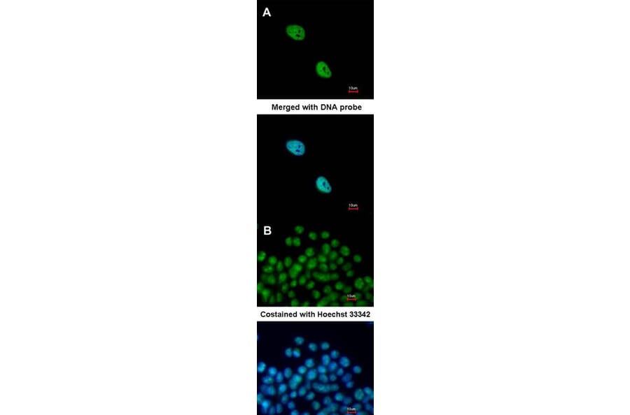Immunofluorescence - NKX2-5 antibody from Signalway Antibody (22771) - Antibodies.com