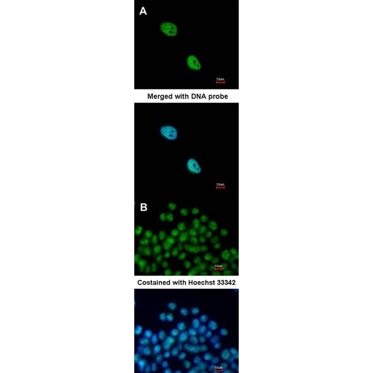 Immunofluorescence - NKX2-5 antibody from Signalway Antibody (22771) - Antibodies.com