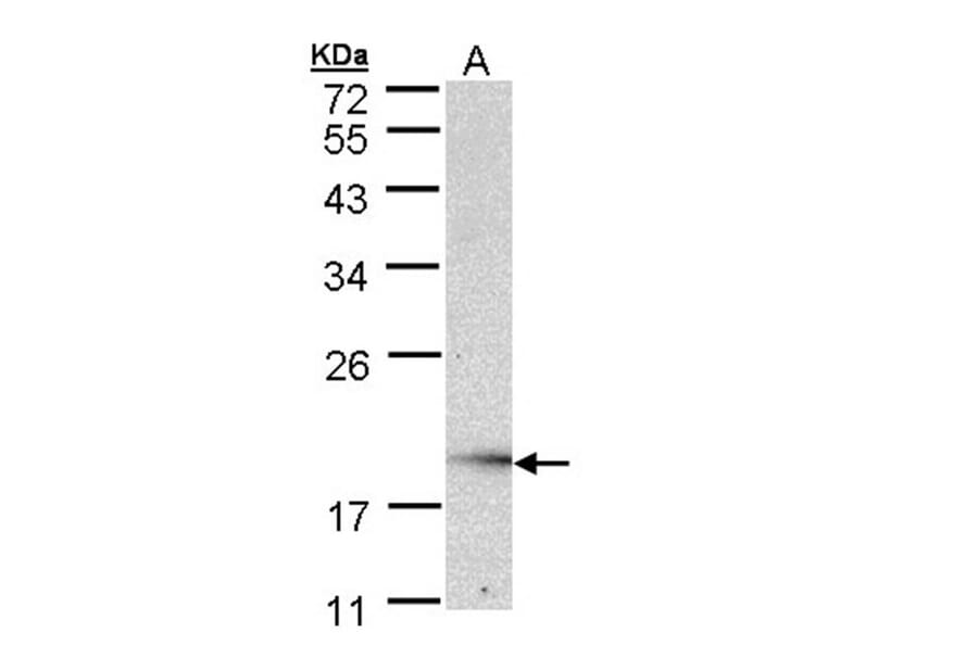 UBE2G2 antibody from Signalway Antibody (22876) - Antibodies.com