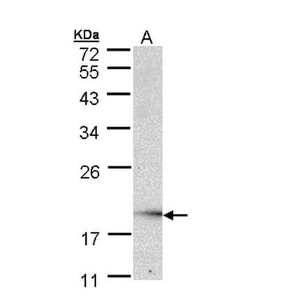 UBE2G2 antibody from Signalway Antibody (22876) - Antibodies.com