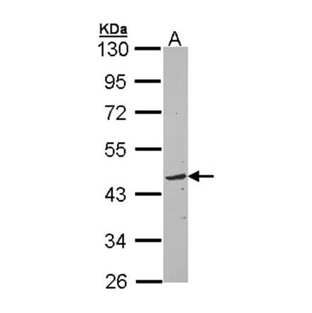 TOM1L1 antibody from Signalway Antibody (22899) - Antibodies.com