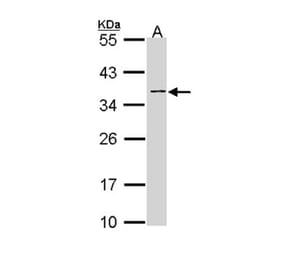 NAGAT antibody from Signalway Antibody (22953) - Antibodies.com