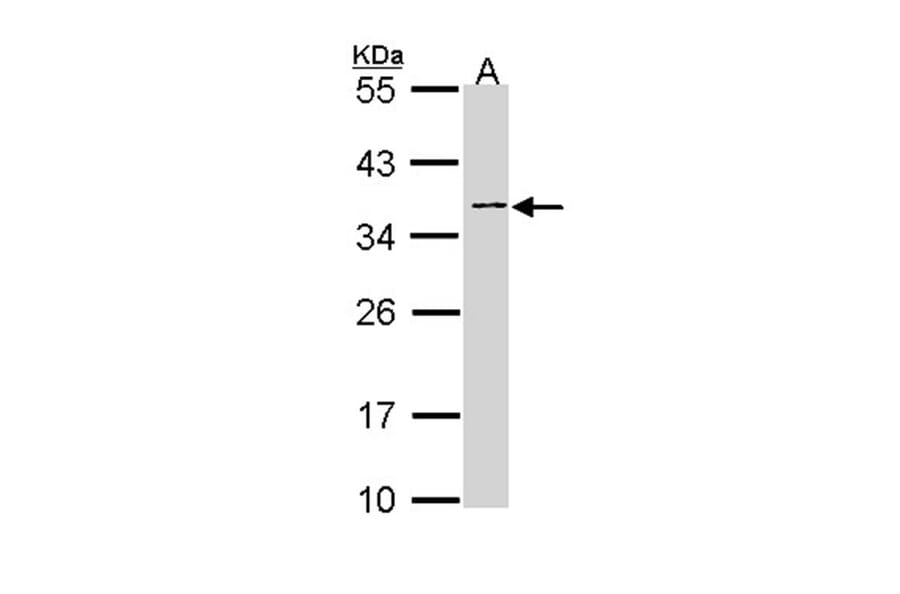NAGAT antibody from Signalway Antibody (22953) - Antibodies.com