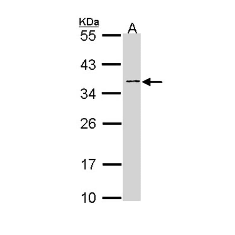 NAGAT antibody from Signalway Antibody (22953) - Antibodies.com