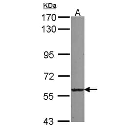 UGT2B7 antibody from Signalway Antibody (23075) - Antibodies.com