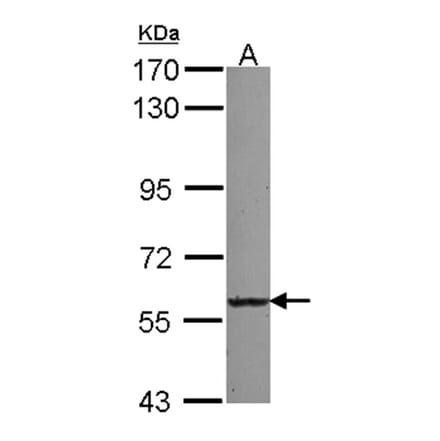 UGT2B7 antibody from Signalway Antibody (23075) - Antibodies.com