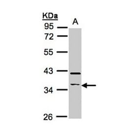 RASSF2 antibody from Signalway Antibody (23100) - Antibodies.com