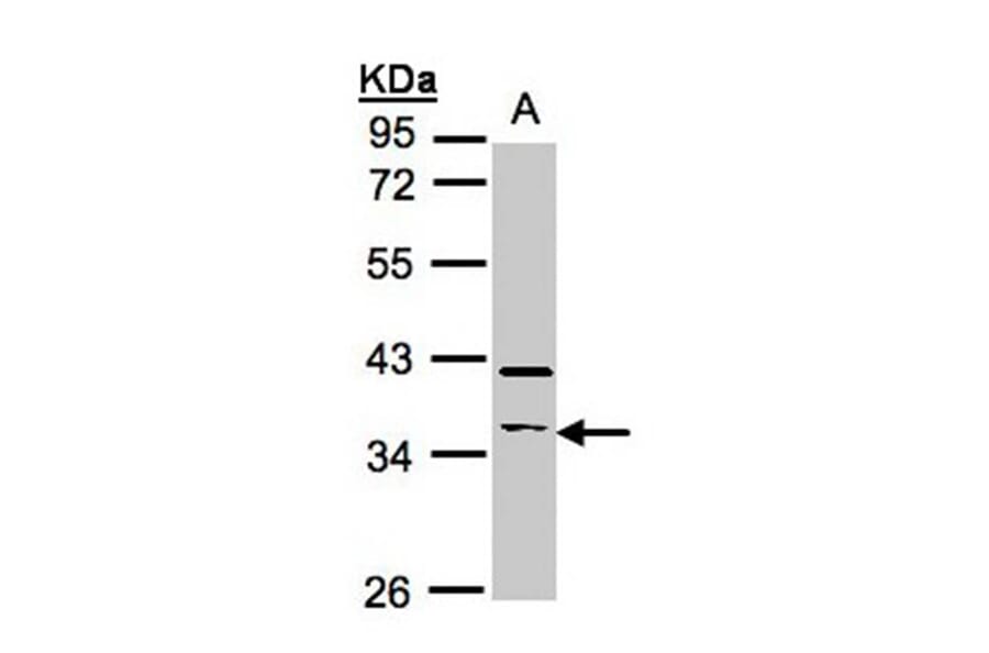 RASSF2 antibody from Signalway Antibody (23100) - Antibodies.com