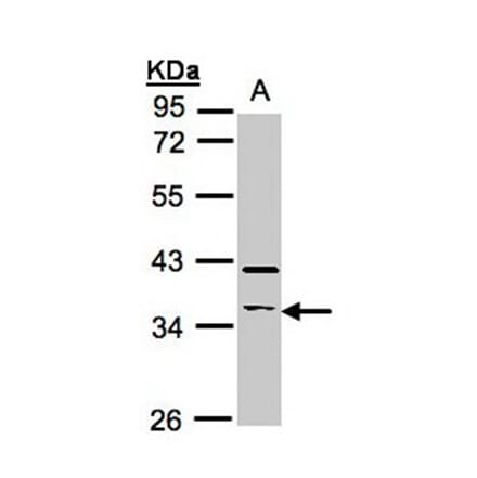 RASSF2 antibody from Signalway Antibody (23100) - Antibodies.com
