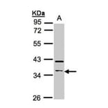 RASSF2 antibody from Signalway Antibody (23100) - Antibodies.com