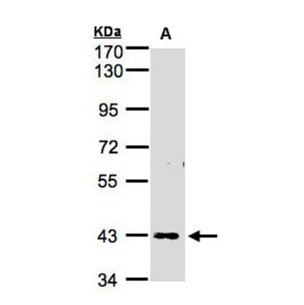 ZNF211 antibody from Signalway Antibody (23109) - Antibodies.com