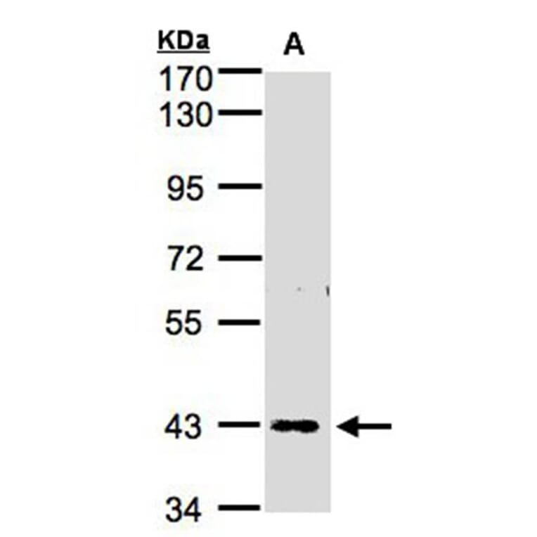 ZNF211 antibody from Signalway Antibody (23109) - Antibodies.com