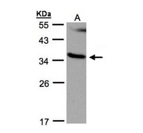 RASSF1 antibody from Signalway Antibody (23115) - Antibodies.com
