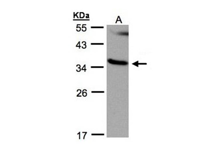 RASSF1 antibody from Signalway Antibody (23115) - Antibodies.com