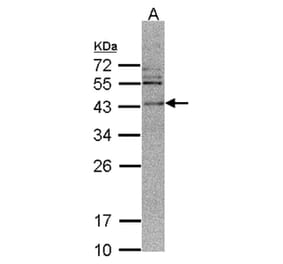 CAMK1D antibody from Signalway Antibody (23143) - Antibodies.com