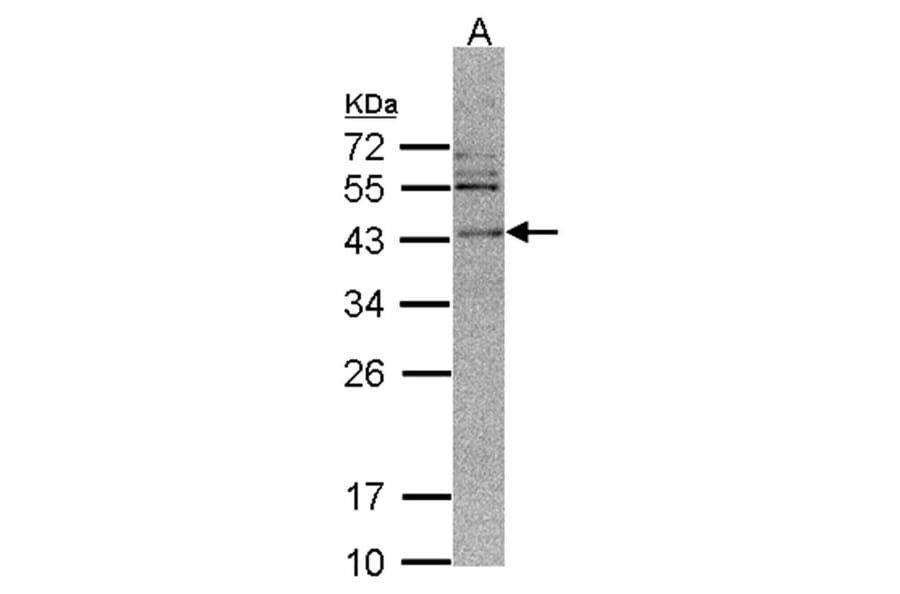 CAMK1D antibody from Signalway Antibody (23143) - Antibodies.com