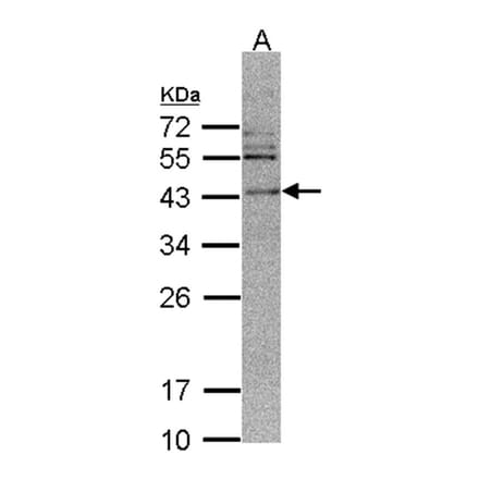 CAMK1D antibody from Signalway Antibody (23143) - Antibodies.com