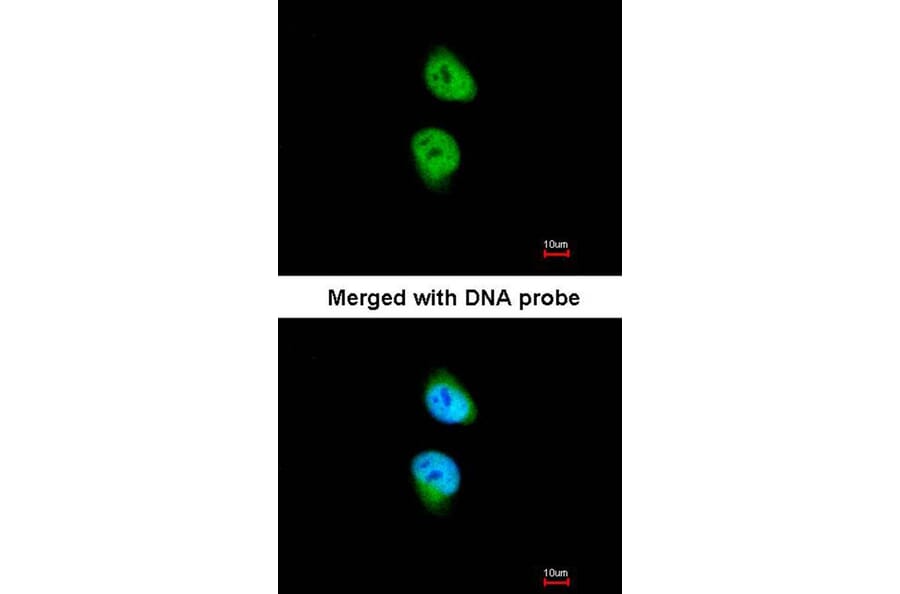 Immunofluorescence - CAMK1D antibody from Signalway Antibody (23143) - Antibodies.com