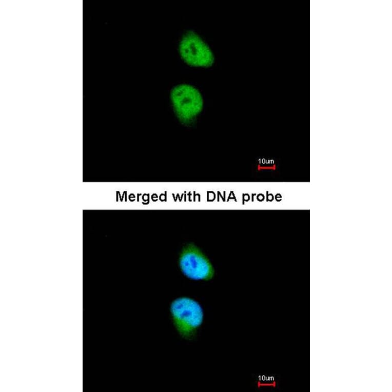 Immunofluorescence - CAMK1D antibody from Signalway Antibody (23143) - Antibodies.com