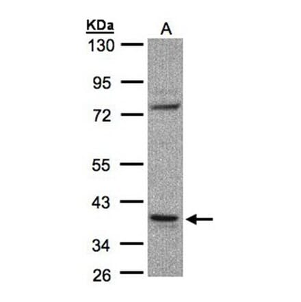 CCDC68 antibody from Signalway Antibody (23155) - Antibodies.com
