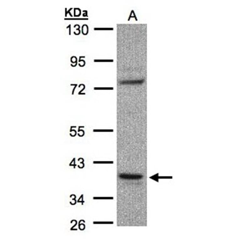 CCDC68 antibody from Signalway Antibody (23155) - Antibodies.com