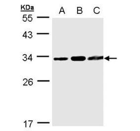 TATDN1 antibody from Signalway Antibody (23157) - Antibodies.com