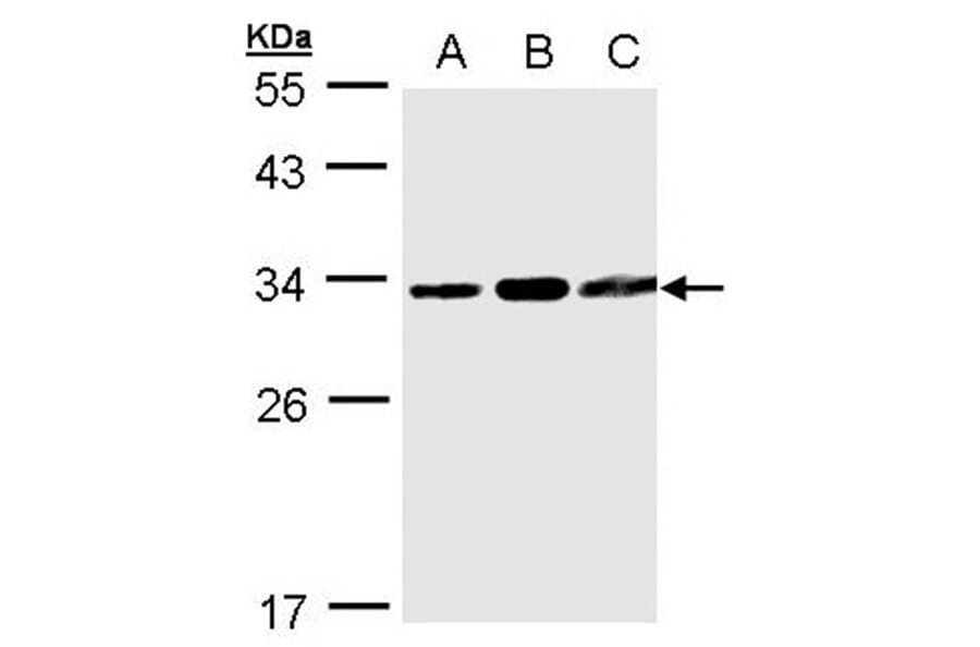 TATDN1 antibody from Signalway Antibody (23157) - Antibodies.com