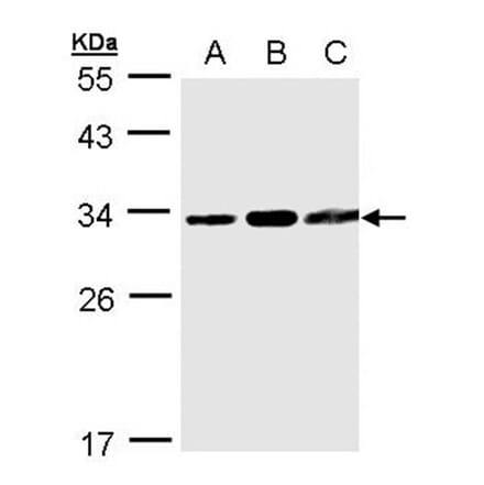 TATDN1 antibody from Signalway Antibody (23157) - Antibodies.com