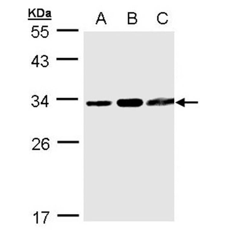 TATDN1 antibody from Signalway Antibody (23157) - Antibodies.com