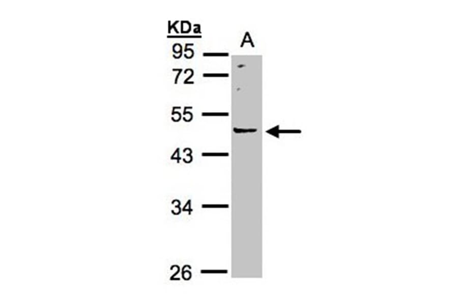 LRRC43 antibody from Signalway Antibody (23179) - Antibodies.com