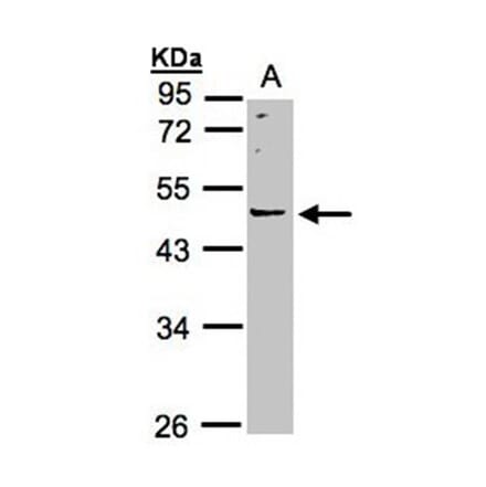 LRRC43 antibody from Signalway Antibody (23179) - Antibodies.com