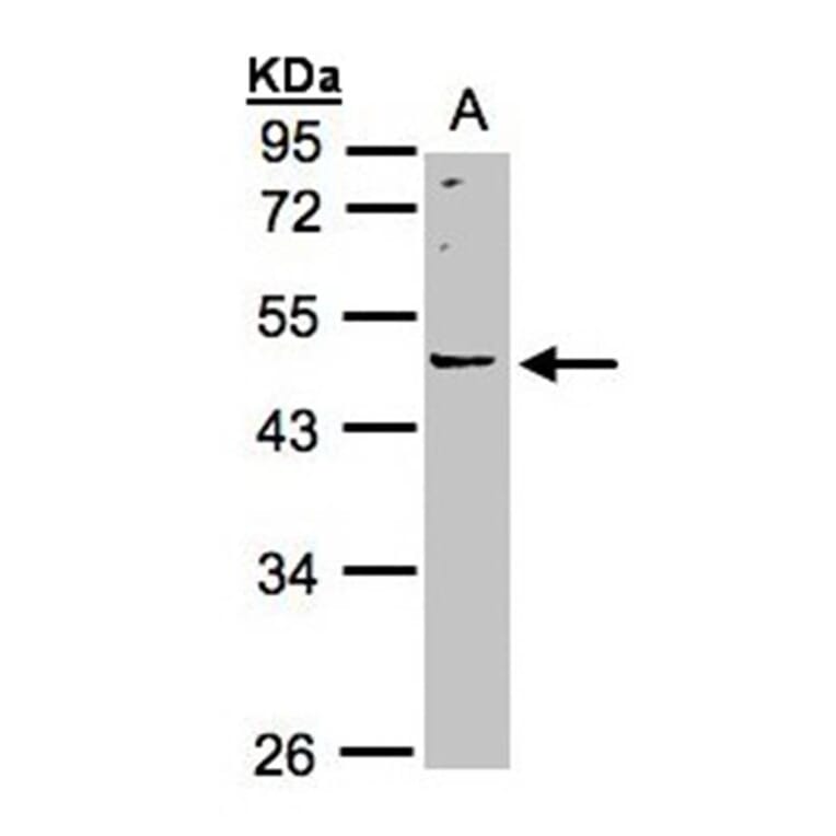 LRRC43 antibody from Signalway Antibody (23179) - Antibodies.com