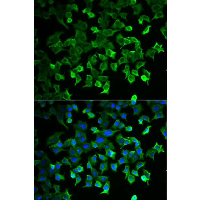 Immunofluorescence - HSPA1A Antibody from Signalway Antibody (32062) - Antibodies.com