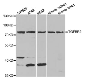 Western blot - TGFBR2 Antibody from Signalway Antibody (32275) - Antibodies.com