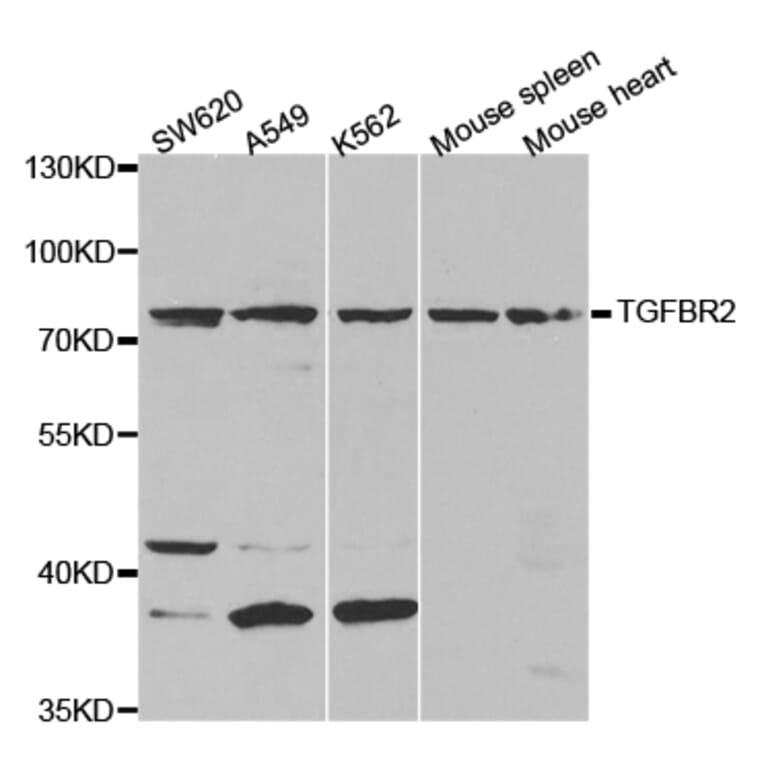 Western blot - TGFBR2 Antibody from Signalway Antibody (32275) - Antibodies.com