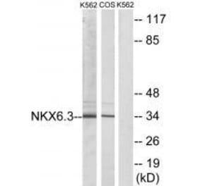 Western blot - NKX6.3 Antibody from Signalway Antibody (33553) - Antibodies.com