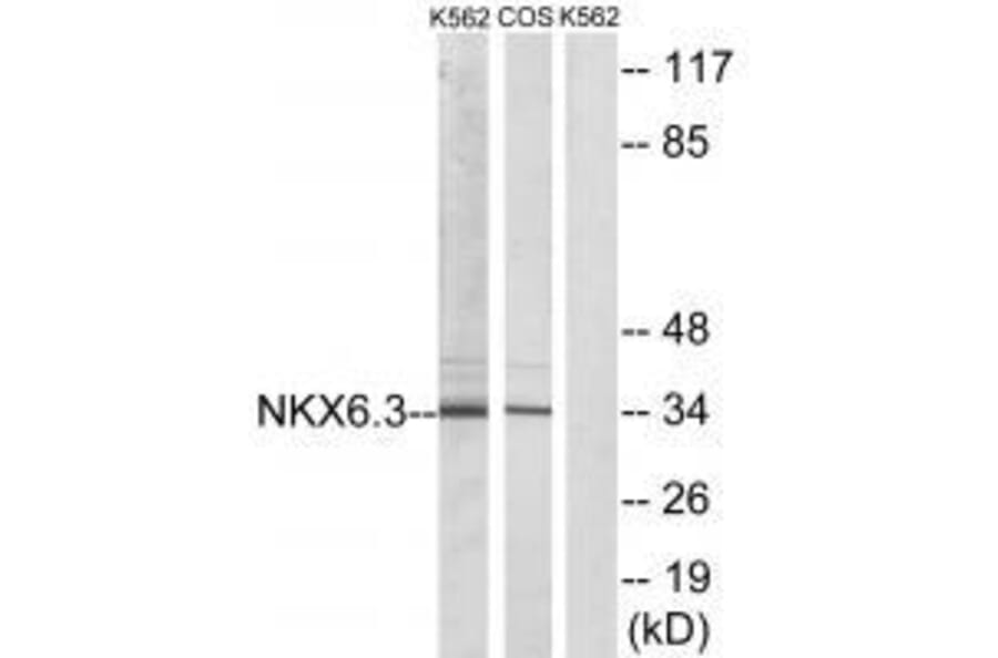 Western blot - NKX6.3 Antibody from Signalway Antibody (33553) - Antibodies.com