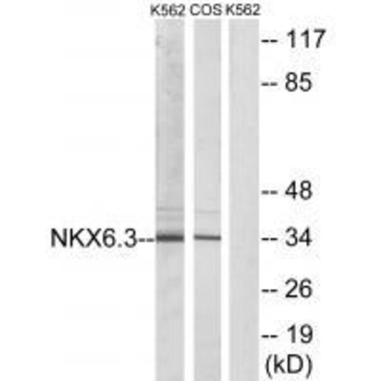 Western blot - NKX6.3 Antibody from Signalway Antibody (33553) - Antibodies.com