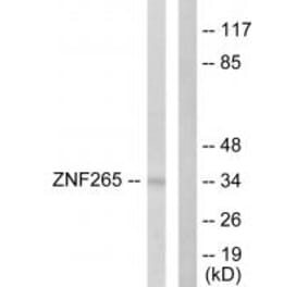 Western blot - ZNF265 Antibody from Signalway Antibody (33627) - Antibodies.com