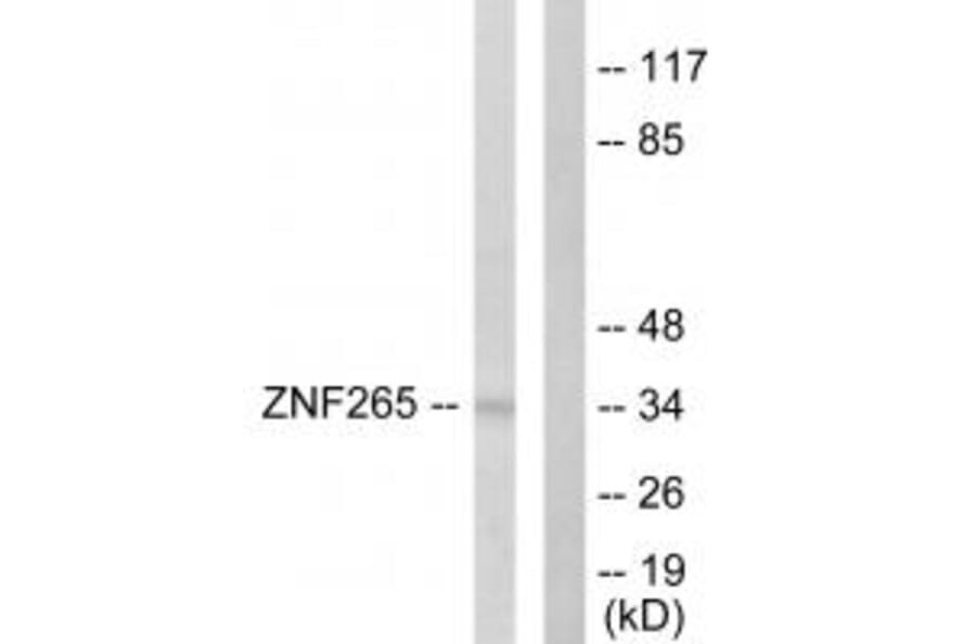 Western blot - ZNF265 Antibody from Signalway Antibody (33627) - Antibodies.com
