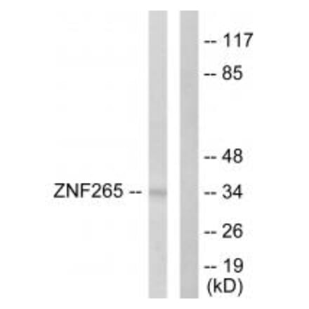 Western blot - ZNF265 Antibody from Signalway Antibody (33627) - Antibodies.com