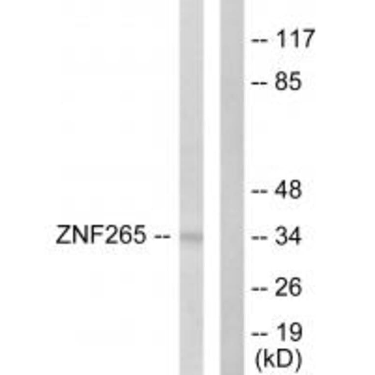 Western blot - ZNF265 Antibody from Signalway Antibody (33627) - Antibodies.com