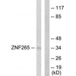 Western blot - ZNF265 Antibody from Signalway Antibody (33627) - Antibodies.com