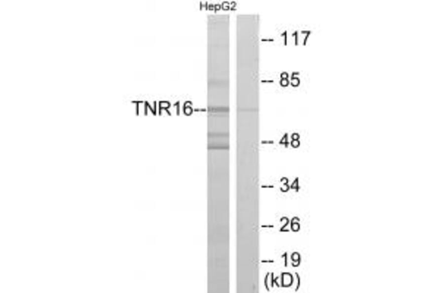 Western blot - TNR16 Antibody from Signalway Antibody (33659) - Antibodies.com
