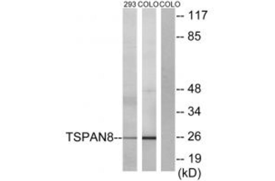 Western blot - TSPAN8 Antibody from Signalway Antibody (33705) - Antibodies.com