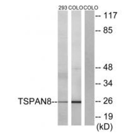 Western blot - TSPAN8 Antibody from Signalway Antibody (33705) - Antibodies.com